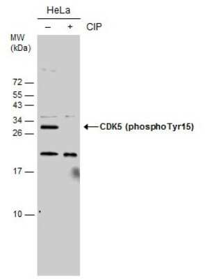 Western Blot: Cdk5 [p Tyr15] Antibody [NBP3-12917]